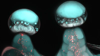 Multi-photon microscopy image of stalked glandular trichome.
