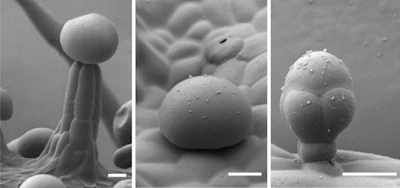 L to R: Stalked, sessile and bulbous glandular trichomes of cannabis plant.
