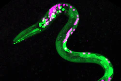 Image of worm that is genetically engineered so that certain neurons and muscles are fluorescent. Green dots are neurons that respond to cannabinoids. Magenta dots are other neurons.