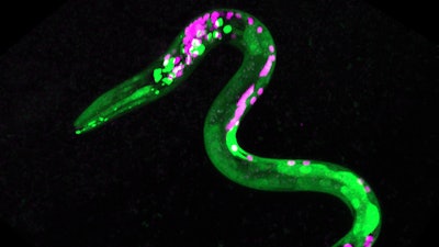 Image of worm that is genetically engineered so that certain neurons and muscles are fluorescent. Green dots are neurons that respond to cannabinoids. Magenta dots are other neurons.