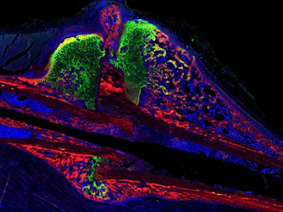 Penn State College of Medicine researchers are studying how cannabinoids may manage pain and promote bone healing in bone fractures. Fluorescence microscopy reveals how periosteal bone progenitors, which later develop into specialized bone cells that help bone tissue for, appear in healing tissue.