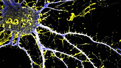 A cortical neuron treated with JRT, a synthetic molecule similar to the psychedelic drug LSD. Drugs like JRT might enable new treatments for conditions such as schizophrenia, without the hallucinations and other side effects of psychedelics.